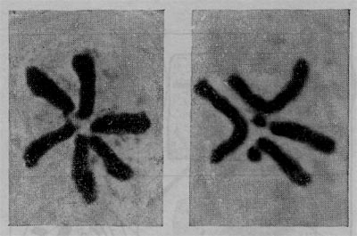 Рис. 36. Диплоидные наборы хромосом в клетках скерды зеленой (Crepis capillaris) — слева и сложноцветного Haplopappus gracilis — справа во время деления клеток. У Haplopappus легко опознать гомологичные хромосомы (хромосомы одной из пар имеют вид дуг; хромосомы другой пары несут на конце по каплевидному образованию, соединенному перемычкой с остальной частью хромосомы, — это так называемый спутник).