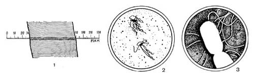–ис. 1. —равнительна¤ величина волоса и бактерий: 1 Ч увеличенное   изображение   волоса (X 500);   2 Ч бактерии в поле зрени¤  светового  микроскопа (X 2000);   з Ч бактерии   под электронным микроскопом (X 20 000).
