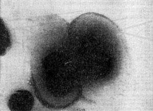 –ис. 7.  апсула клеток Azotobacter chroococcum. ”вел. X 25 000.
