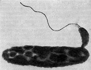–ис. 22. ѕрикрепление паразитической бактерии Bdellovibrio к клетке хоз¤ина Ч Pseudomonas (по Ўтольлу, 1963).