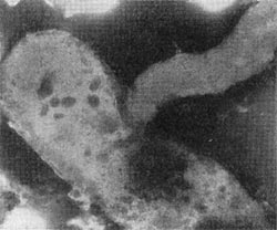 –ис. 24. јтака  паразитической   бактерией  клетки-хоз¤ина. ”вел, х 35000.