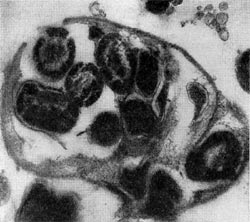 –ис. 25.  летка бактерии-хоз¤ина (Tuberoidobacter sp.), заполненна¤ размножившимис¤ паразитами. Ёлектронна¤ микрофотографи¤. ”вел, х 40000.