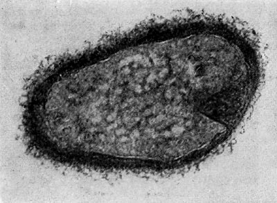 –ис. 26. ÷исты (форма поко¤) паразитических бактерий Bdellovibrio. ”вел. X 50000.
