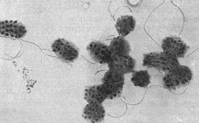 –ис. 28. ѕочвенна¤ бактерп¤ со сферическими выступами на поверхности клетки (Agrobacterium polyspheroidum). ”вел. X 15000.