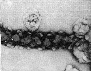 –ис. 29.  летка бактерии с бугристыми выростами представитель нового рода Tuberoidobacter. ”вел. X 30000.