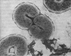 –ис. 32. “ороидальные клетки Microcyclus flavus. Ёлектронна¤ микрофотографи¤. ”вел. X 25000.