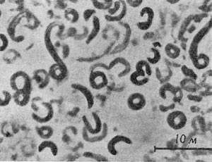 –ис. 41. ¬егетативные клеткп в виде вибрионов, торондов и спирилл у Desulfotomaculum sp. (сульфатредуцпрующа¤ бактери¤). ”вел. X 2100.