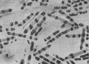 –ис. 46. ћолодые, интенсивно дел¤щиес¤ клетки —1оstridium sporopenitum. ¬идны дел¤щиес¤ нуклеоиды. ќкраска ¤дерного вещества по методу –омановского Ч √имза. ”вел. X 3500.