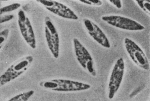 –ис. 47.  лострнднальна¤ форма клеток Clostridium butyricum. ”вел. X 3500.