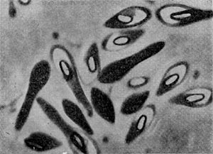 –ис. 48.  лостридиальна¤ форма клеток. —поры снабжены светлыми конусовидными колпачками. Clostridium species, шт. 1. ”вел. X 3500.
