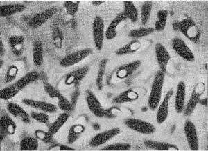 –ис. 49.  лострпдиальна¤ форма клеток при спорообразовании. —поры со светлыми конусовидными колпачками. Clostridium sp. ”вел. X 3500.