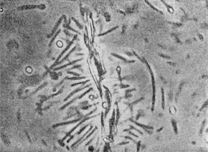 –ис. 51. ѕлектридтти, адсорбированные на целлюлозном волокне. ( летчаткоразрушающне бактерии.) ”вел. X 3500.