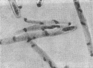 –ис. 54. ќбразование ¤дерных т¤жей в процессе спорообразовани¤. Clostridium sporopenilum.  ”вел. X 3500.