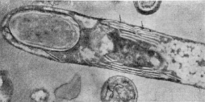 –ис. 60. ”льтратонкий срез клеток Cl. taeniosporum. –еакци¤ на дегидрогеназы. —трелками показаны отложени¤ теллура. ¬идны выросты п светлые шаровидные включени¤ гранулезы. ”вел. X 45 000.