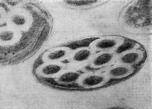 –ис. 61. ѕоперечный ультратонкнй срез клеток —1. penicillum. ’орошо заметен лизис цитоплазмы вокруг трубчатых выростов (светлые зоны). ”вел. X 96 000.