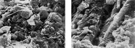–ис. 120. ћикроструктура микробных очагов (фото   в   сканирующем электронном   микроскопе).   ”вел. X 1600.