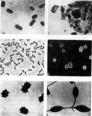 –ис. 124. ћикрофотографии разных  видов  фототрофных бактерий. —нимки   1 Ч 4   сделаны   в   световом   микроскопе,    а    снимки 5 Ч 6 Ч в  электронном  микроскопе.