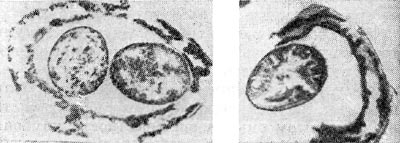 –ис. 145. ќбразование (слева) и выход (справа) артросиор из клеток клубеньковых бактерий клевера. ”льтратонкие срезы. ”вел. X 30 000.