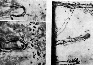 –ис. 148. —коплени¤ клубеньковых бактерий вокруг корневых волосков. —трелкой показано движение клеток клубеньковых бактерий к вершине корневого волоска клевера.