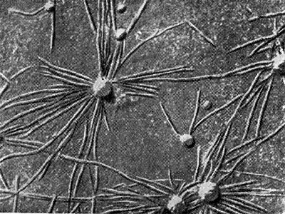 –ис. 149.  летки клубеньковых бактерий на поверхности инфицированного корневого волоска бобового растени¤ (по ѕ. ƒарту, ‘. ћерсеру).