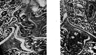 –ис. 154. »нтерцеллюл¤рные инфекционные нити в виде кармана (справа) и факела (слева) с клубеньковыми бактери¤ми. —трелкой показана клетка бактерий, приготовивша¤с¤ к выходу в цитоплазму растительной клетки. ”вел. X 20 000.