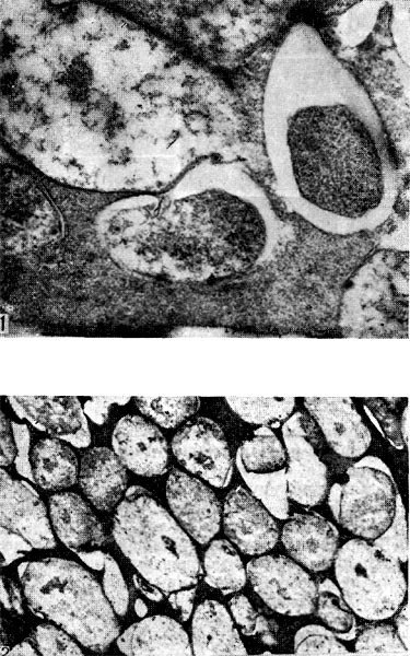 –ис. 161. ѕереход бактерий в бактероиды (1 Ч увел. ’25 000) и сформировавша¤с¤ бактероидна¤ ткань (2 Ч увел. X15 000) в клубеньках люцерны.