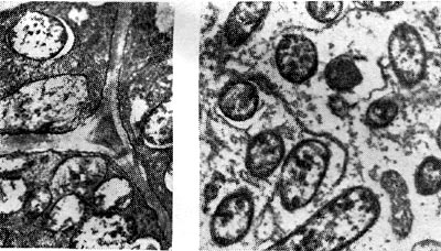–ис. 162. Ѕактеропдна¤ ткань в период активного функционировани¤ клубеньков клевера (слева увел. X 10 000) и вики посевной (справа Ч увел. X 6000).