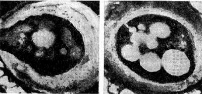 –ис. 175. ÷исты азотобактера (по ». „ану и др.). «рела¤ циста, наполненна¤ гранулами жира и окруженна¤ толстой плотной оболочкой (справа), и прорастающа¤ циста (растуща¤ молода¤ клетка разрывает оболочку цисты Ч слева). ”вел. X 35 000.