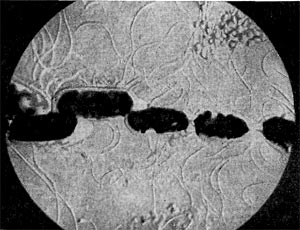 –ис. 186. ¬озбудитель бактериального ув¤дани¤ абрикосовых деревьев. ¬идны клетки со жгутиками. Ёлектронно-микроскопический снимок. ”вел. X 20 000.