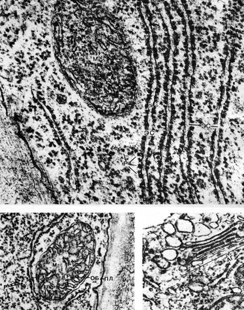 Таблица 10. Структура растительной клетки. Вверху — гранулярная эндоплазматическая сеть в цитоплазме развивающегося корневого волоска редиса (Raphanus sativus). Электронная микрофотография (увел, х 103 000) М. Ф. Даниловой: эс — каналы эндоплазматической сети; р — рибосомы; м — митохондрия. Внизу слева -- митохондрия в развивающемся корневом волоске редиса (Raphanus sativus). Электронная микрофотография (увел, х 85000) Е. А. Мирославова: м—митохондрия; об — оболочка; гр — гребни; пл — плазмалемма (под ней видна часть оболочки клетки); эс — каналы эндоплазматической сети, на внешних поверхностях которых видны рибосомы; р — свободные рибосомы в цитоплазме. Внизу справа — аппарат Гольджи в цитоплазме развивающегося корневого волоска редиса (Raphanus sativus). Электронная микрофотография (увел. х 52 000) М. Ф. Даниловой: аг — аппарат Гольджи, видны срезы плоских мешочков и пузырьков.