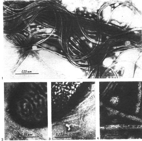 “аблица 43. ∆гутики (1) и нитевидные выросты Ч фимбрии (2Ч4) у клеток клубеньковых бактерий люпина. —трелками показаны места выхода фимбрии из клетки (по ћайеру).